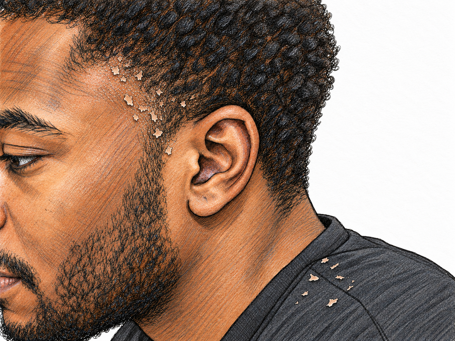Close-up of dry skin flakes lifting from a man's scalp along his hairline, with a few shed flakes resting on his dark shirt shoulder.