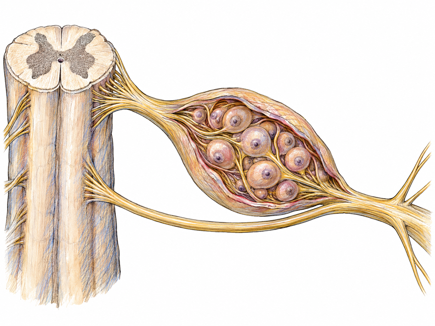 A text-free anatomical cutaway of a spinal dorsal-root ganglion, showing a compact cluster of nerve-cell bodies within a swelling clearly outside the spinal cord.